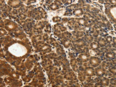 ODC1 Antibody