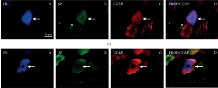 GOAT ANTI RAT CALCITONIN GENE-RELATED PEPTIDE