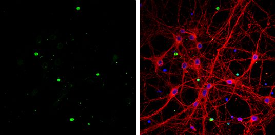 OLIG1 Rabbit Polyclonal Antibody