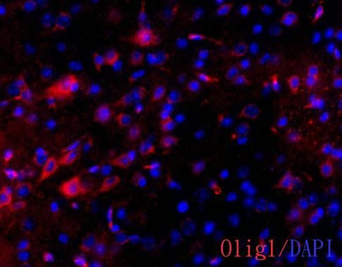 OLIG1 Rabbit Polyclonal Antibody