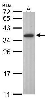 OLIG1 Rabbit Polyclonal Antibody