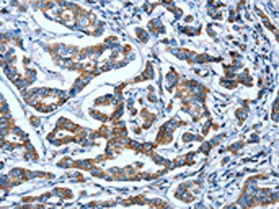 OPRD1 Antibody