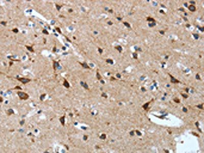 OPRD1 Antibody