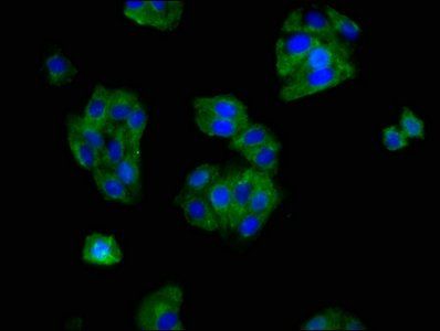 OPRM1 Antibody