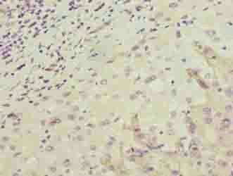 OR2H1 Antibody