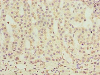 OR2H1 Antibody