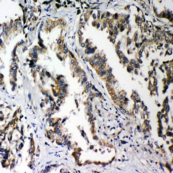 PLK2 Rabbit Polyclonal Antibody