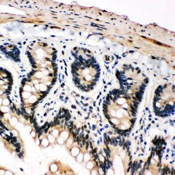 PLK2 Rabbit Polyclonal Antibody