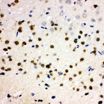 PLK2 Rabbit Polyclonal Antibody