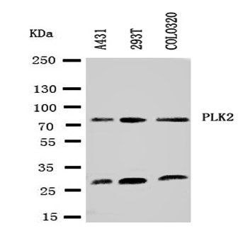 PLK2 Rabbit Polyclonal Antibody