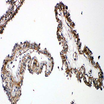 Parathyroid Hormone Receptor 1/PTH1R Rabbit Polyclonal Antibody