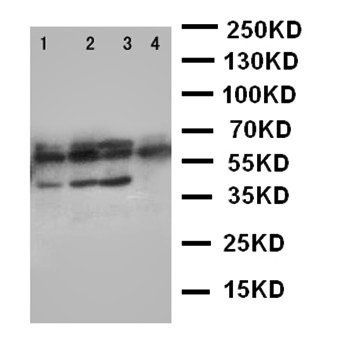 Parathyroid Hormone Receptor 1/PTH1R Rabbit Polyclonal Antibody