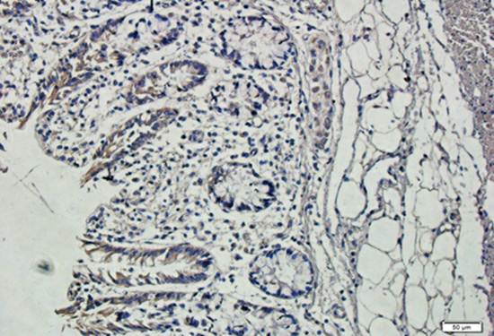 TIMP1 antibody
