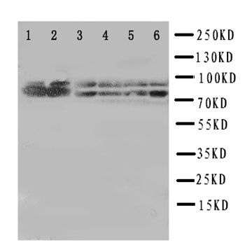 B Raf/BRAF Rabbit Polyclonal Antibody