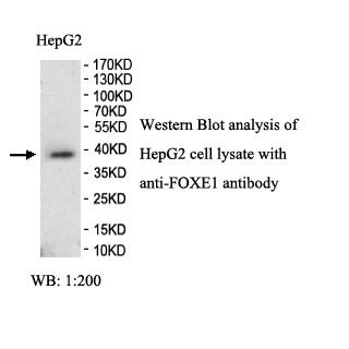 FOXE1 Rabbit Polyclonal Antibody