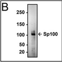 Sp100 Antibody