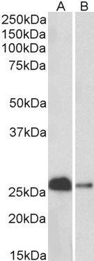 calbindin D28 Antibody