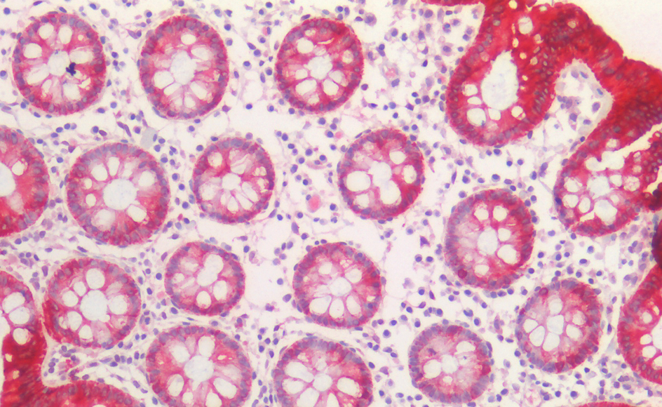 Goat anti-cytokeratin 20 (aa48-60) Antibody