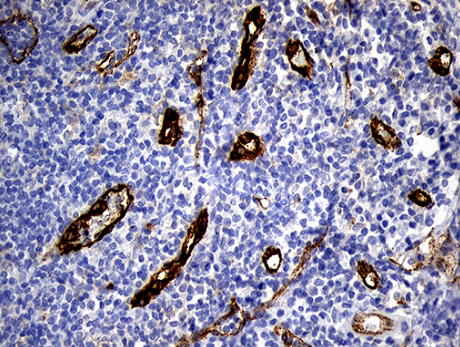 TM4SF2 Antibody