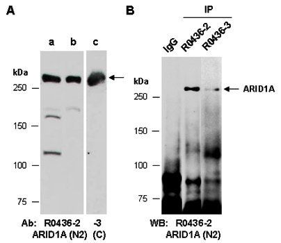 ARID1A (vPairTM) Antibodies