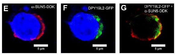 DDK (FLAG) Antibody