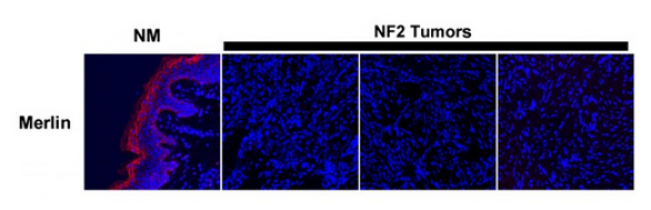 DDK (FLAG) Antibody