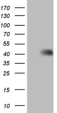 HOMER2 Antibody