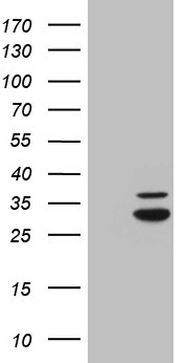 MRRF Antibody