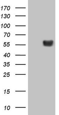 LRRC6 Antibody