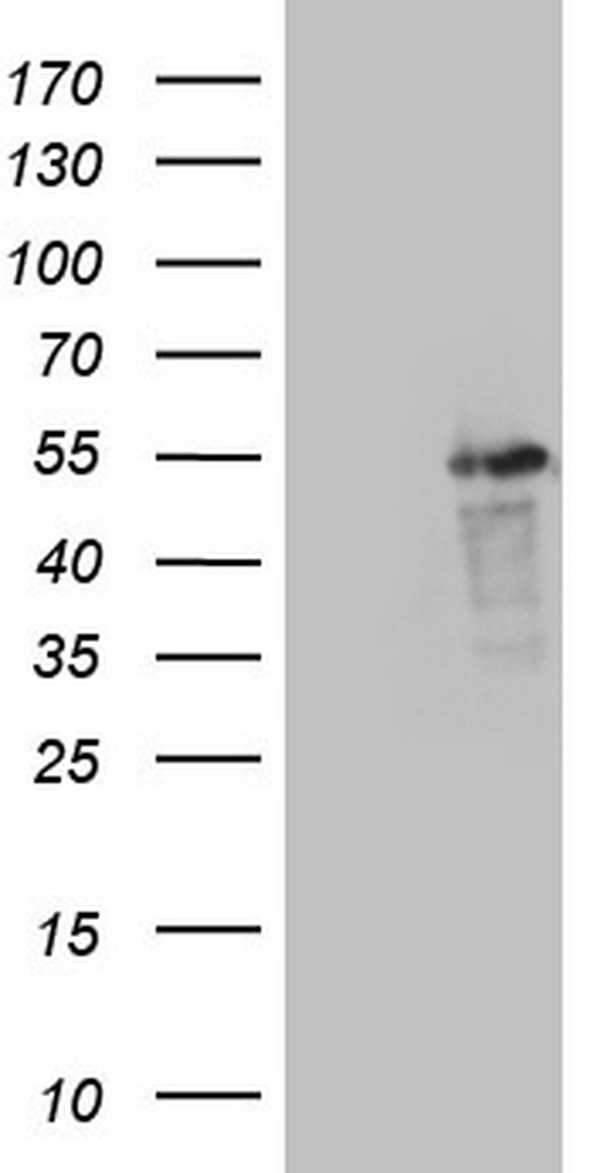 LRRC6 Antibody