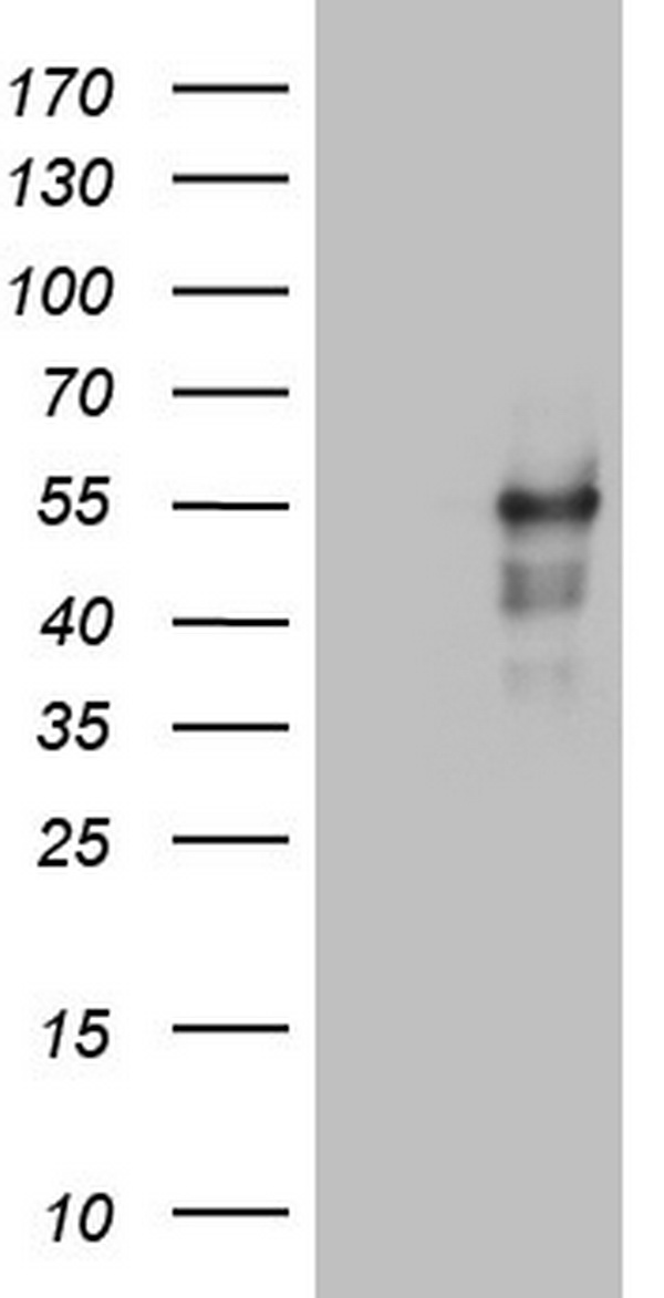 LRRC6 Antibody