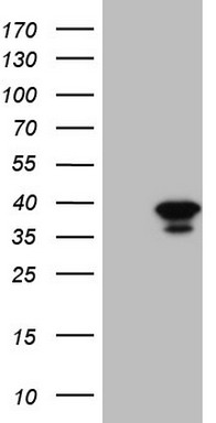 Gemin 8 Antibody