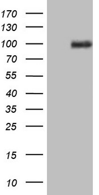 PRKD3 Antibody