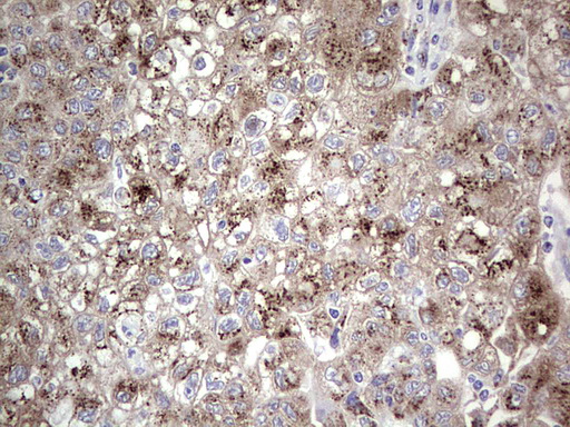 ALKBH1 Antibody