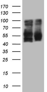 LRRTM1 Antibody