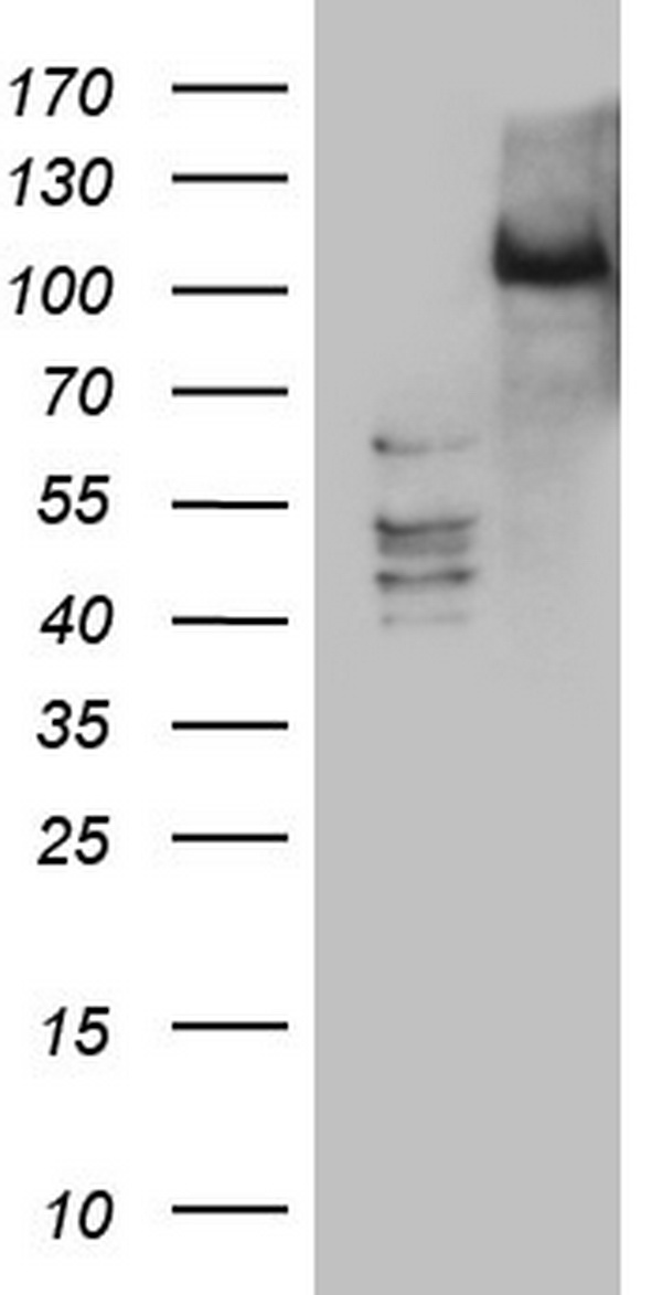 PRKD3 Antibody