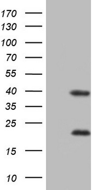 Constitutive androstane receptor Antibody