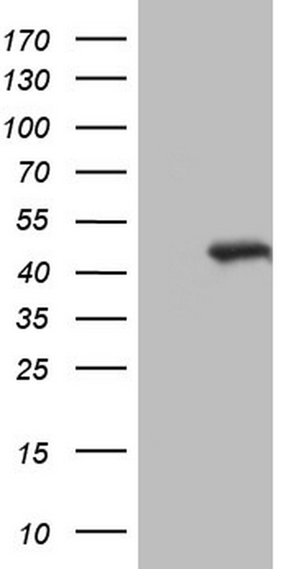 Constitutive androstane receptor Antibody