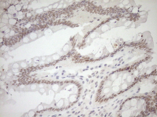 Constitutive androstane receptor Antibody