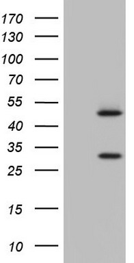 Constitutive androstane receptor Antibody