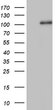 CD56 Antibody