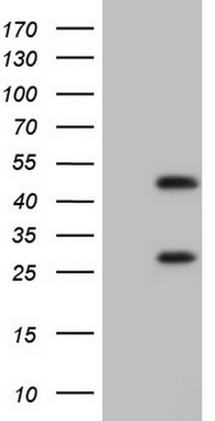 Constitutive androstane receptor Antibody