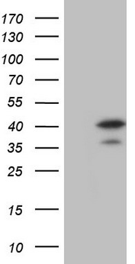 MAD2L1BP Antibody