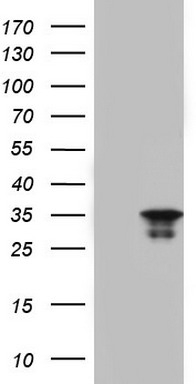 Galectin 3 Antibody
