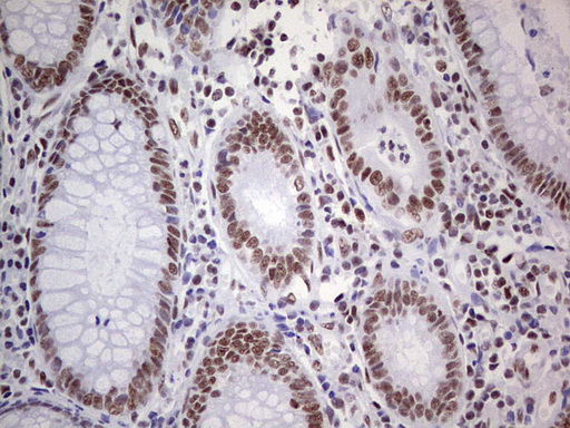 PPP1R8 Antibody