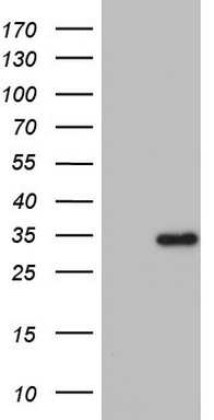 ENTPD1 Antibody