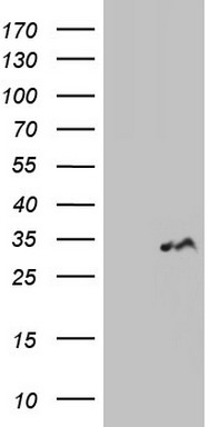 Galectin 3 Antibody