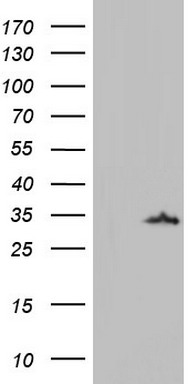 Galectin 3 Antibody