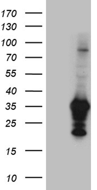 Galectin 3 Antibody