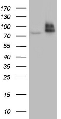 RRM1 Antibody